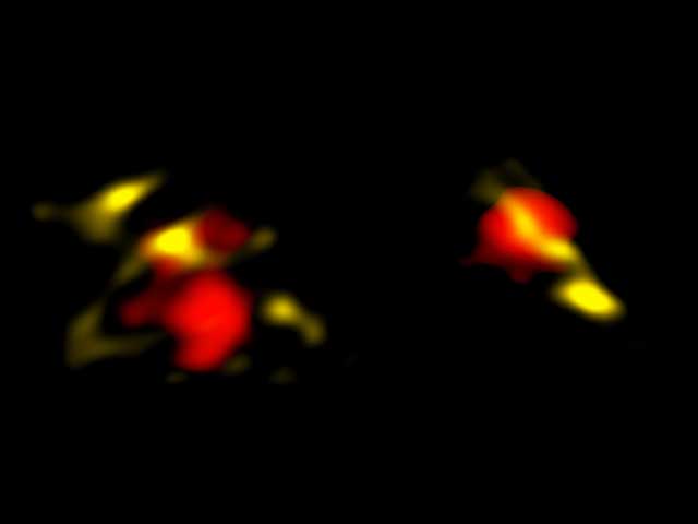 figure: These are two of the galaxies in the early universe that ALMA observed in radio waves.